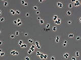 This microscopic image shows dozens of individual bacterial cells of the recently discovered species Tersicoccus phoenicis.